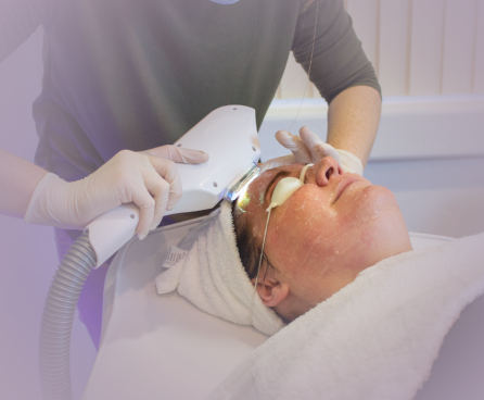All About IPL Aesthetic Devices Pros and Cons