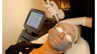 How Do Laser Devices Treat Signs of Aging