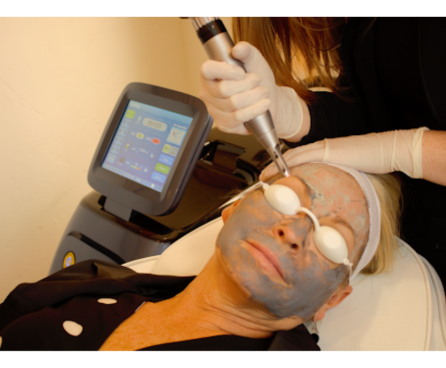 How Do Laser Devices Treat Signs of Aging