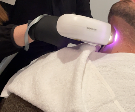 Sleek Confidence- A Dive Into Diode Laser Body Hair Removal for Men